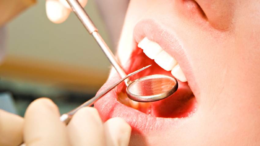 Виды зубных опухолей
